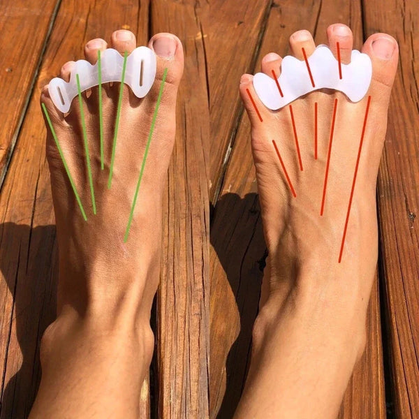 Correcteurs d'orteils Unisexe pour Hallux Valgus - Lot de 2